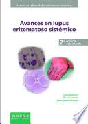 Avances en lupus eritematoso sistémico