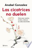 Las cicatrices no duelen