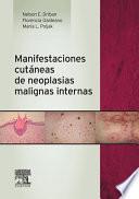 Manifestaciones cutáneas de neoplasias malignas internas