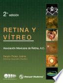 Retina y vítreo